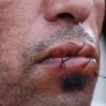 PROROGA STATO DI EMERGENZA – PARTITO RADICALE: PREANNUNCIARLO FUORI DALLE SEDI ISTITUZIONALI E’ MANCANZA DI SENSO DELLO STATO